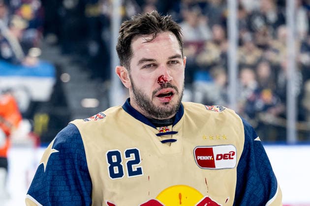 Sport Bilder des Tages Chris DeSousa (EHC Red Bull Muenchen, 82) hat sich hier eine blutige Nase geholt, das Foul blieb unbestraft GER, EHC Red Bull Muenchen vs. Grizzlys Wolfsburg, Eishockey, DEL, 49. Spieltag, Saison 2025 2026, 06.03.2026. GER, EHC Red Bull Muenchen vs. Grizzlys Wolfsburg, Eishockey, DEL, 49. Spieltag, Saison 2025 2026, 06.03.2026. Muenchen *** Chris DeSousa EHC Red Bull Muenchen, 82 got a bloody nose here, the foul went unpunished GER, EHC Red Bull Muenchen vs Grizzlys Wolfsburg, Ice Hockey, DEL, 49 Matchday, Season 2025 2026, 06 03 2026 GER, EHC Red Bull Muenchen vs Grizzlys Wolfsburg, Ice Hockey, DEL, 49 Matchday, Season 2025 2026, 06 03 2026 Muenchen Copyright: xEibner-Pressefoto HeikexFeinerx EP_HFR