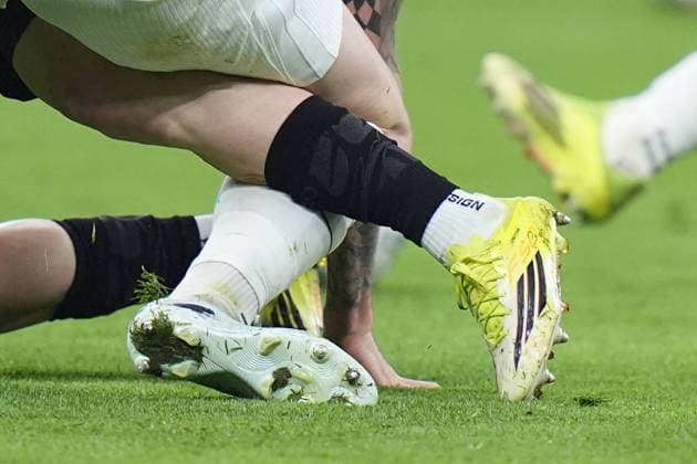 tackle during the Serie A soccer match between Milan and Inter at the San Siro Stadium in Milan , north Italy - Sunday , March 08 , 2026. - Soccer .  Copyright: xSpada LaPressex