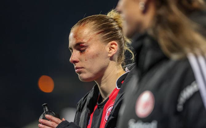GER, Frankfurt, Eintracht Frankfurt vs TSG Hoffenheim, Google Pixel Bundesliga, Fussball, DFB, Spielzeit 2025 2026, Stadion am Brentanobad, 15. Spieltag im Bild: Verletzung bei Laura Freigang (Eintracht Frankfurt Frauen 10), Blut, Auge, verletzt, Auswechslung DFB DFL REGULATIONS PROHIBIT ANY USE OF PHOTOGRAPHS AS IMAGE SEQUENCES AND OR QUASI-VIDEO, 18.03.2026 Copyright: HMBxMedia HendrikxHamelau