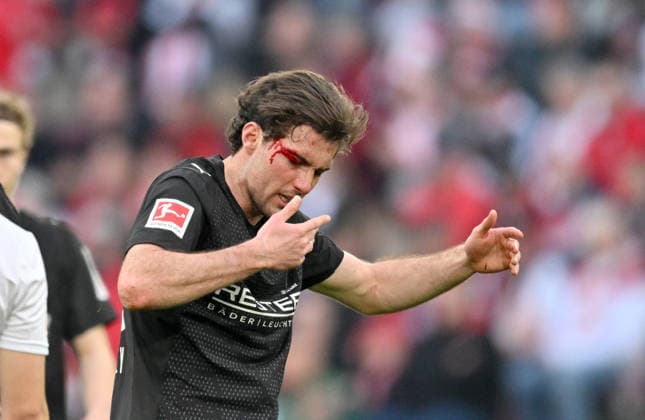 Joe Scally (Bor. Mönchengladbach) mit blutiger Wunde am Kopf, Blut, nach einem Schlag von Eric Martel (1. FC Köln nicht im Bild). Fussball 1. Bundesliga, 27.Spieltag, 1. FC Koeln - Borussia Moenchengladbach 3:3 am 21.03.2026 in Koeln Deutschland. DFL regulations prohibit any use of photographs as image sequences and or quasi-video Â *** Joe Scally Bor Mönchengladbach with bloody wound on the head, blood, after a blow from Eric Martel 1 FC Köln not in picture Football 1 Bundesliga, 27 Matchday, 1 FC Koeln Borussia Moenchengladbach 3 3 on 21 03 2026 in Koeln Germany DFL regulations prohibit any use of photographs as image sequences and or quasi video Â
