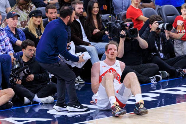March 25, 2026, Inglewood, California, USA: Jakob Poeltl 19 of the Toronto Raptors bleeds from a cut to the face during regular season NBA, Basketball Herren, USA game against the Los Angeles Clippers on Wednesday March 25, 2026 at Intuit Dome in Inglewood, California. ARIANA RUIZ PI Clippers Vs. Raptors  - ZUMAp124 20260325_zaa_p124_004 Copyright: xArianaxRuizx