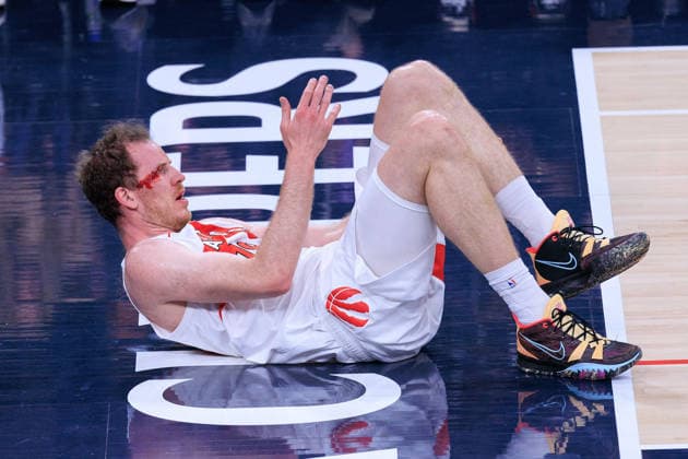 March 25, 2026, Inglewood, California, USA: Jakob Poeltl 19 of the Toronto Raptors bleeds after being stroke to the side of the right eye during a regular season NBA, Basketball Herren, USA game against the Los Angeles Clippers on Wednesday March 25, 2026 at Intuit Dome Arena in Inglewood, California. JAVIER ROJAS PI. Inglewood USA - ZUMAp124 20260325_zaa_p124_005 Copyright: xJavierxRojasx