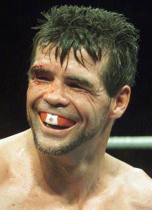 September 6, 2002, Montreal, Pq, Canada: ARCHIVES - Alex Hilton, de Montro al, sourit aproÂ¨s avoir o to mis K.-O. par Alain Bonnamie au septioÂ¨me round de leur combat en comptant huit chez les super-moyens o Montro al, le vendredi 6 septembre 2002. (PHOTO CP , archives) ALEX HILTON  - ZUMAc35_ 20020906_zaf_c35_001 Copyright: xRyanxRemiorzx