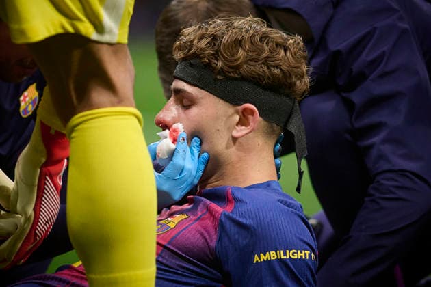 Atletico de Madrid v FC Barcelona, Barca - UEFA Champions League 2025 2026 - Quarter-final, 2nd leg FC Barcelona™s -Fermin Lopez injured during Champions League 2025 2026, quarter-final, 2nd leg, April 14 ,2026. (ALTERPHOTOS Ropero) MadridSpain  Copyright: xRoperox
