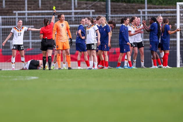 16.04.2026, Essen, Fußball, UEFA Womens UNDER 19 Championship qualification, Germany - France, Stadion Uhlenkrug, Saison 2025 2026: Rudelbildung Gruppenbildung Handgemenge neben Schiedsrichterin DFB regulations prohibit any use of photographs as image sequences and or quasi-video. Nordrhein-Westfalen Deutschland