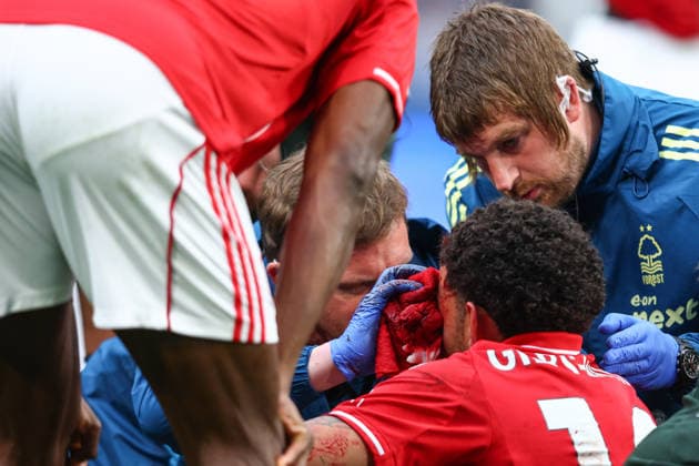 Premier League: Chelsea v Nottingham Forest LONDON, UK - 4th May 2026: A blood drenched towel is seen as medics treat Morgan Gibbs-White of Nottingham Forest after a clash of heads with Robert Sanchez of Chelsea during the Premier League match between Chelsea FC and Nottingham Forest FC at Stamford Bridge London Stamford Bridge England United Kingdom Copyright: xCraigxMercerx xPeakxActionxPhotosx