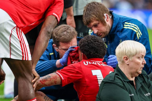 Chelsea v Nottingham Forest, Premier League Morgan Gibbs-White of Nottingham Forest, head bleeding, during the Chelsea v Nottingham Forest Premier League match at Stamford Bridge, London, England on 4 May 2026 Credit: Ian Stephen Every Second Media Editorial use only. All images are copyright Every Second Media Limited. No images may be reproduced without prior permission. All rights reserved. Premier League and Football League images are subject to licensing agreements with Football DataCo Limited. see https: www.football-dataco.com Copyright: xIMAGO EveryxSecondxMediax ESM-1973-0080 IanxStephenx xEveryxSecondxMediax