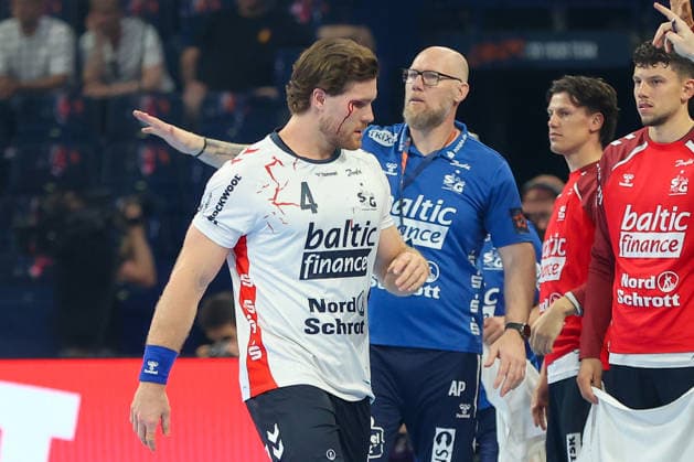 30.05.2026, xgox, Handball - EHF European League Halbfinale MT Melsungen - SG Flensburg-Handewitt v.l. Johannes Golla (Flensburg, 4) blutet am Auge, verletzung, verletzt Hamburg