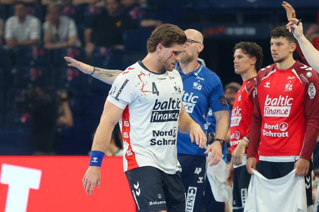 30.05.2026, xgox, Handball - EHF European League Halbfinale MT Melsungen - SG Flensburg-Handewitt v.l. Johannes Golla (Flensburg, 4) blutet am Auge, verletzung, verletzt Hamburg