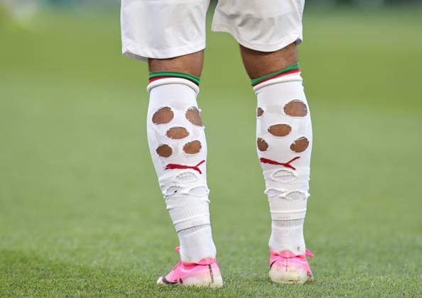 June 19, 2026, Foxborough, Massachusetts, USA: Holes in a players socks during the June 19th FIFA World Cup, WM, Weltmeisterschaft, Fussball 2026 matchup between Scotland and Morocco at Gillette Stadium in Foxborough, Massachusetts. FIFA World Cup 2026: Scotland 0:1 Morocco  - ZUMAs325 20260619_zsp_s325_115 Copyright: xJessxStilesx