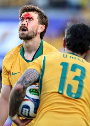 (260626) -- SAN FRANCISCO, June 26, 2026 -- Connor Metcalfe (L) of Australia sustains an injury during the group D match between Paraguay and Australia at the 2026 FIFA World Cup, WM, Weltmeisterschaft, Fussball at San Francisco Bay Area Stadium in San Francisco, the United States, June 25, 2026. (Photo by Xinhua) (SP)U.S.-SAN FRANCISCO-FOOTBALL-FIFA WORLD CUP-GROUP D-PRY VS AUS SongxHaiyuan 