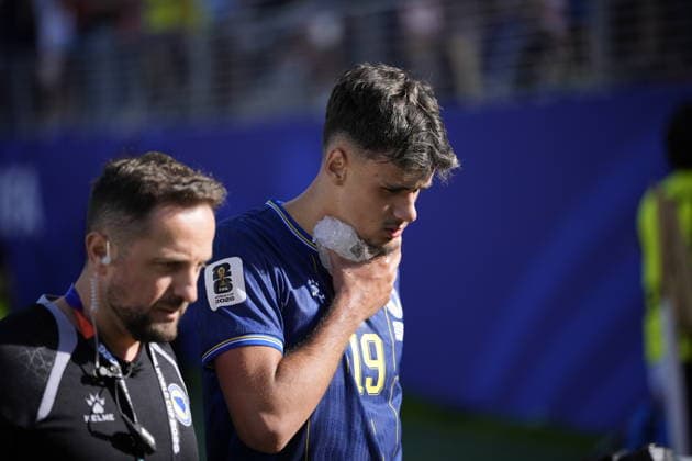 USA v Bosnia and Herzegovina - FIFA World Cup, WM, Weltmeisterschaft, Fussball 2026 - Round of 32 SANTA CLARA, CALIFORNIA - JULY 1: Kerim Alajbegovic (19) of Bosnia and Herzegovina gets injured during the 2026 FIFA World Cup Round of 32 match between USA vs Bosnia and Herzegovina at the San Francisco Stadium (Levi s Stadium) in Santa Clara, California, United States on July 1, 2026. Tayfun Coskun Anadolu California United States. Editorial use only. Please get in touch for any other usage.  Copyright: x2026xAnadoluxTayfunxCoskunx
