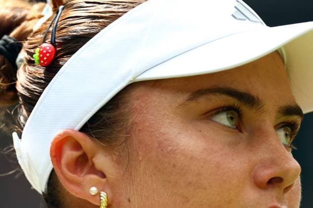 Strawberry hairclip of Iva Jovic during her fourth round match Wimbledon Tennis Championships, Day 7, The All England Lawn Tennis and Croquet Club, London, UK - 05 Jul 2026London The All England Lawn Tennis and United Kingdom  Copyright: xJamesxMarsh Shutterstockx 16976811i