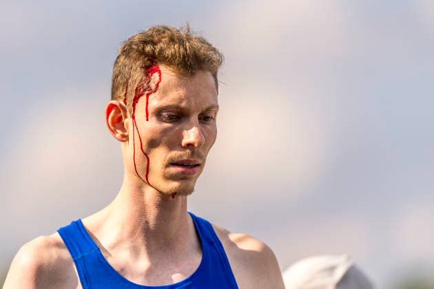 Deutsche Leichtathletik-Meisterschaften; Bochum-Wattenscheid, 25.07.2026 Tobias Potye (Munich Athletics) verletzt sich am Kopf beim Hochsprung; Deutsche Leichtathletik-Meisterschaften am 25.07.2026 im Lorheide-Stadion, Bochum-Wattenscheid (Nordrhein-Westfalen). *** German Track and Field Championships, Bochum-Wattenscheid, July 25, 2026: Tobias Potye of Munich Athletics suffered a head injury during the high jump at the German Track and Field Championships on July 25, 2026, at Lorheide Stadium in Bochum-Wattenscheid, North Rhine-Westphalia Copyright: xBEAUTIFULxSPORTS AxelxKohringx