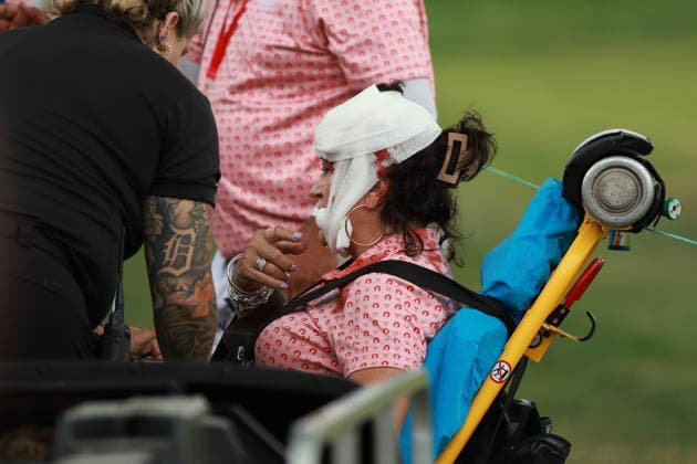 Rocket Classic DETROIT, MICHIGAN - AUGUST 1: A volunteer is treated by medical staff after being hit by a golf ball on the 17th hole during the third round of the Rocket Classic 2026 at the Detroit Country Club in Detroit, Michigan, MI, USA Saturday, August 1, 2026. Detroit Michigan United States  Copyright: xJorgexLemusx originalFilename:lemus-rocketcl260801_npzpZ.jpg