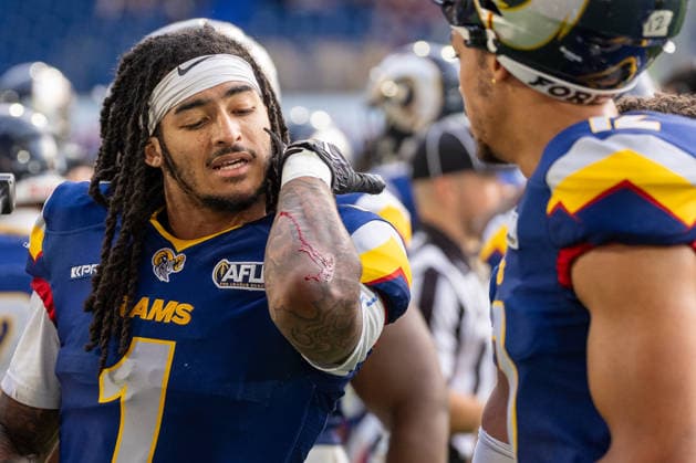 Cameron Bergeron (Alpine Rams, 01) blutet am Arm, GER Rhein Fire vs. Alpine Rams, American Football, AFLE, Saison 2026, 01.08.2026 GER Rhein Fire vs. Alpine Rams, American Football, AFLE, Saison 2026, 01.08.2026 Duisburg *** Cameron Bergeron, Alpine Rams, 01, bleeding from the arm, GER Rhein Fire vs. Alpine Rams, American Football, AFLE, 2026 Season, August 1, 2026, GER Rhein Fire vs. Alpine Rams, American Football, AFLE, 2026 Season, August 1, 2026, Duisburg Copyright: xEibner-Pressefoto FabianxFriesex EP_FFE