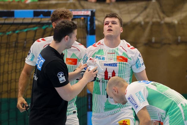 07.08.2026, xtgx, Handball Turnier, EHV Aue - SC Magdeburg emspor, v.l. Elvar Orn Jonsson (Magdeburg, 19) verletzt, Verletzung, Auge Lößnitz *** August 7, 2026, xtgx, Handball Tournament, EHV Aue vs. SC Magdeburg emspor, from left: Elvar Orn Jonsson (Magdeburg), 19 injured, injury, Auge Lößnitz