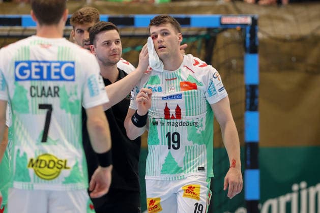 07.08.2026, xtgx, Handball Turnier, EHV Aue - SC Magdeburg emspor, v.l. Elvar Orn Jonsson (Magdeburg, 19) verletzt, Verletzung, Auge Lößnitz *** August 7, 2026, xtgx, Handball Tournament, EHV Aue vs. SC Magdeburg emspor, from left: Elvar Orn Jonsson (Magdeburg), 19 injured, injury, Auge Lößnitz