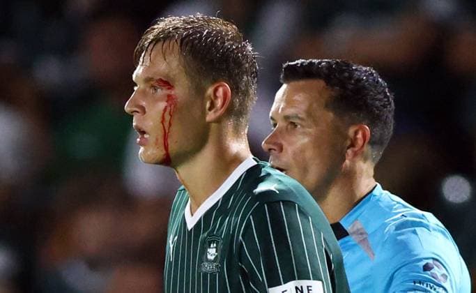 Mathias Ross of Plymouth Argyle with a bloody face Plymouth Argyle v Exeter City, EFL Carabao Cup, First Round, Football, Home Park, Plymouth, UK - 10 Aug 2026Plymouth Home Park United Kingdom EDITORIAL USE ONLY No use with unauthorised audio, video, data, fixture lists, club league logos or live services. Online in-match use limited to 120 images, no video emulation. No use in betting, games or single club league player publications.  Copyright: xKieranxMcManus Shutterstockx 17061087bj