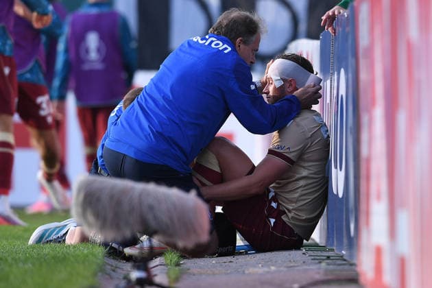 Fußball DFB-Pokal 1. Runde SC Preußen Münster - Karlsruher SC am 21.08.2026 im LVM-Preußenstadion in Münster Christoph Kobald ( Karlsruhe ) mit Kopfverband am Spielfeldrand DFB regulations prohibit any use of photographs as image sequences and or quasi-video. *** Soccer, DFB Cup, First Round: SC Preußen Münster vs. Karlsruher SC on August 21, 2026, at the LVM Preußenstadion in Münster. Christoph Kobald of Karlsruhe, wearing a head bandage, stands on the sidelines. DFB regulations prohibit any use of photographs as image sequences and or quasi-video. xRx