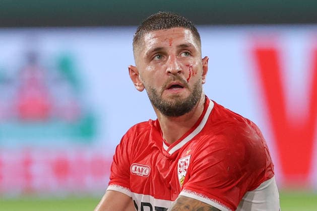 21.08.2026, xtgx, Fussball DFB-Pokal 1. Runde, FC Hansa Rostock - VfB Stuttgart, v.l. Jeff Chabot (Stuttgart, 24) verletzt, Verletzung, injury, injured, Kopf, Auge, Blut, blutet (DFL DFB REGULATIONS PROHIBIT ANY USE OF PHOTOGRAPHS as IMAGE SEQUENCES and or QUASI-VIDEO) Rostock *** August 21, 2026, xtgx, Soccer DFB Cup First Round, FC Hansa Rostock vs. VfB Stuttgart, from left: Jeff Chabot (Stuttgart), 24, injured, injury, head, eye, blood, bleeding. DFL and DFB regulations prohibit any use of photographs as image sequences and or quasi-video. Rostock