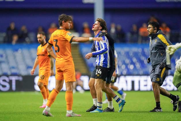 Sheffield Wednesday v Wolverhampton Wanderers, Carabao Cup Sheffield Wednesday forward Harry Gray (24) injured during the Sheffield Wednesday v Wolverhampton Wanderers Carabao Cup 2nd Round match at Hillsborough Stadium, Sheffield, England on 25 August 2026 Credit: Eleanor Hoad Every Second Media Editorial use only. All images are copyright Every Second Media Limited. No images may be reproduced without prior permission. All rights reserved. Premier League and Football League images are subject to licensing agreements with Football DataCo Limited. see https: www.football-dataco.com Copyright: xIMAGO EveryxSecondxMediax ESM-2115-0030 EleanorxHoadx xEveryxSecondxMediax