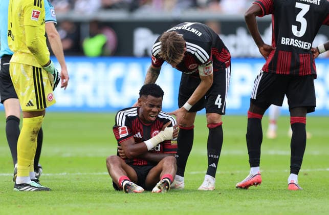 19.09.2026, Fussball Bundesliga, Eintracht Frankfurt - SC Freiburg, v.l., Raphael Onyedika (Eintracht Frankfurt) hält sich die Schulter mit schmerzverzerrtem Gesicht DFL DFB REGULATIONS PROHIBIT ANY USE OF PHOTOGRAPHS AS IMAGE SEQUENCES AND OR QUASI-VIDEO. xdcx Copyright: HMBxMedia Claus