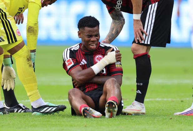 19.09.2026, Fussball Bundesliga, Eintracht Frankfurt - SC Freiburg, v.l., Raphael Onyedika (Eintracht Frankfurt) hält sich die Schulter mit schmerzverzerrtem Gesicht DFL DFB REGULATIONS PROHIBIT ANY USE OF PHOTOGRAPHS AS IMAGE SEQUENCES AND OR QUASI-VIDEO. xdcx Copyright: HMBxMedia Claus