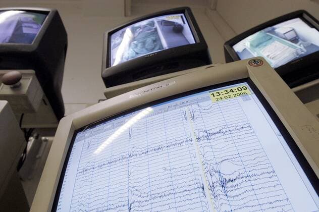 Computermonitor mit EEG-Kurven darüber Videoüberwachung der Patienten im Epilepsie-Zentrum des Evangelischen Krankenhauses Königin Elisabeth Herzberge in Berlin