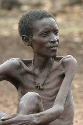IMAGO Creative: Hunger abgemagerter Toposa-Mann, Sudan Toposa man, just skin and bones, Sudan BLWS037928