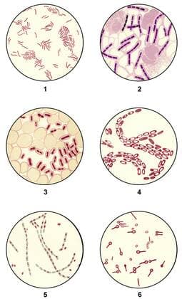 Bakterienausstriche von Krankheitserregern für die mikrobiologische Diagnostik, Mikropräparate aus der medizinischen Mikrobiologie, Stand der Wissenschaft um 1915, Abb.1: Cholera-Vibrionen oder Vibrio cholerae, Abb. 2: Milzbrandbazillen oder Bacillus anthracis, Abb. 3: Kapselbazillen, Abb. 4: Kartoffelbazillus oder Bacillus mesentericus, Abb. 5: Milzbrandbazillen oder Bacillus anthracis, Abb. 6: Tetanusbazillen oder Clostridium tetani iblhdf02266032