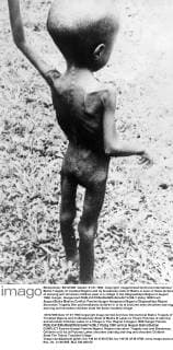 Biafra Tragedy of troubled Nigeria and its breakaway state of Biafra is seen in these pictures of starving and shrunken children seen in a village in the Oklgweafikpo Region 2 August 1968, Hunger, Hungersnot  UnitedArchives00941290