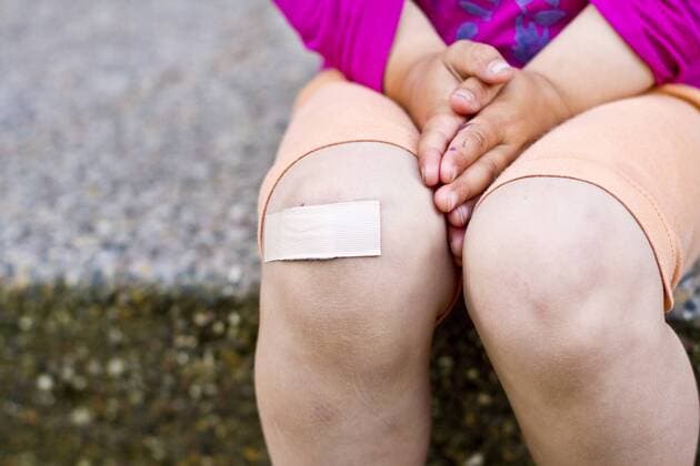 Germany, Kiel, Girl with patch on knee, close up model released  JFEF000160