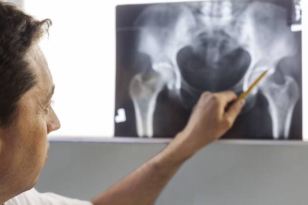Doctor pointing at x-ray of a pelvis model released Symbolfoto  BZF000094