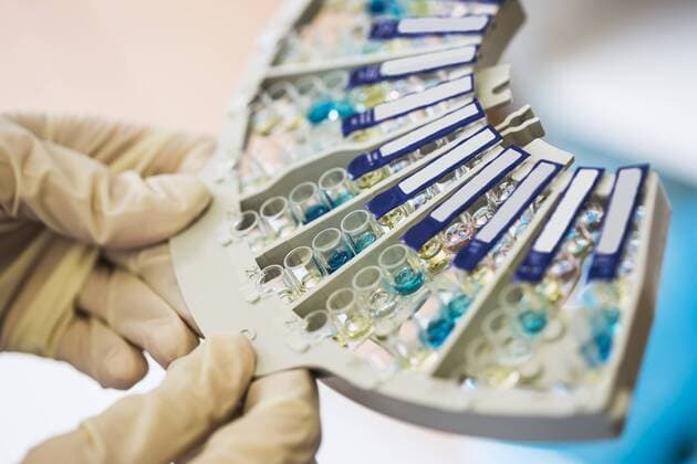 Analysing of blood sample, antibody test model released Symbolfoto property released  DISF001652