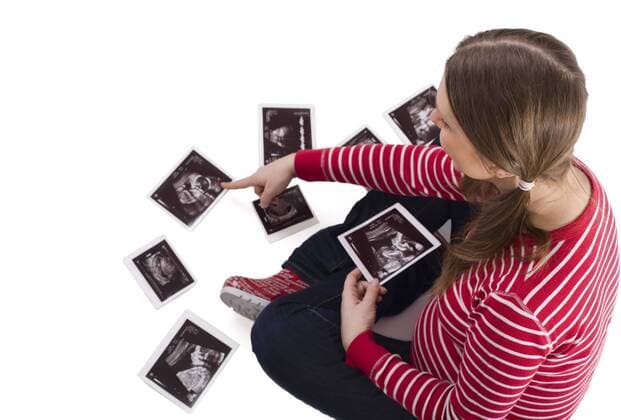 schwangere junge Frau sitzt auf dem Boden und schaut sich in freudiger Erwartung Ultraschallbilder ihres Kindes an pregnant young woman sitting on the floor excitedly watching ultrasonic pictures of her child BLWS234182
