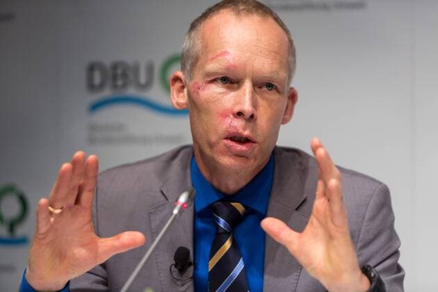 DEU, Deutschland, Nordrhein-Westfalen, Essen, 08.11.2015: Deutsche Bundesstiftung Umwelt (DBU) Deutscher Umweltpreis Pressekonferenz Prof. Dr. Johan Rockström, Stockholm Resilience Centre an der Stockholmer Universität (Hinweis: Prof. Rockström hatte kürzlich einen Fahrradunfall, daher resultieren die Narben im Gesicht)