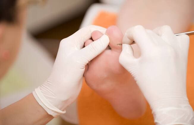 Fusspflegerin bei der Arbeit, entfernt Hornhaut pedicurist removing callus BLWS241587