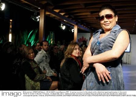 A woman survivor to the attack with a chemical agent participates in the event Model for a Day in Bogota, Colombia, 15 December 2015. Twelve women from the Foundation Rebuilding Faces took the catwalk and raised their voice against gender violence. EFE MAURICIO DUENAS CASTANEDA WOMEN VICTIMS OF ACID ATTACKS PARTICIPATE IN FUNDRAISING EVENT BOG33  !ACHTUNG: NUR REDAKTIONELLE NUTZUNG!