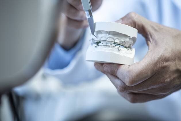 Orthodontist holding dental mold with braces model released Symbolfoto property released  ZEF10607