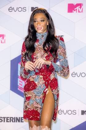 Winnie Harlow arrives at the MTV Europe Music Awards in Rotterdam, The Netherlands on November 6, 2016.  ROT20161106880 SVENxHOOGERHUIS