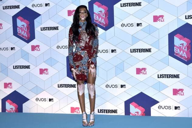 Winnie Harlow bei der Verleihung der MTV Europe Music Awards 2016 im Ahoy Rotterdam. Roterdam, 06.11.2016 Foto:xA.xHübnerx xFuturexImage