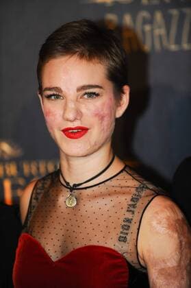 Die Insel der besonderen Kinder Filmpremiere in Rom Foto IPP CavalierexEmiliano Roma 05 12 2016 Roma. Red Carpet. Miss Peregrine. La casa dei ragazzi speciali -- Bebe Vio  0