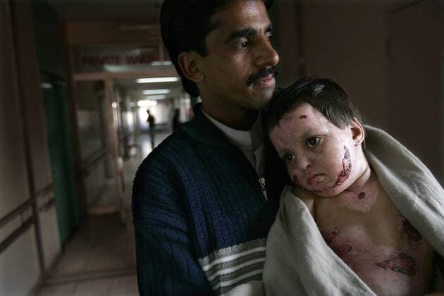 Dec 02, 2005; Islamabad, PAKISTAN; Aftermath of Pakistan earthquake on October 8, 2005. At the Pakistan Institute of Medical Sciences Hospital in Islamabad, NADRA (cq, age4) HUSSAIN from Bagh, Kashmir along with her father, ASGHAR (cq) HUSSAIN make their way out of the hospital. NADRA who along with her family were living in the tent shelters was burned 10 days following the earthquake. While living in the tent shelters, and after quake caused Nadra to run from her family tent which was set on fire from a outdoor cooking flame, she tripped and became trapped in the fire causing injuries to her face and chest and loosing portions of her finger tips. Mandatory - ZUMAs44_ 20051202_jab_s44_117 Copyright: xNelvinxC.xCepedax