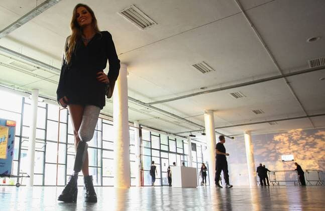 Bilder des Tages Sao Paulo Fashion Week - Paola Antonini Fotoshooting Sao PAULO, SP - 13.03.2017: SPFW N43 - In the photo, the mining model, Paola Antonini, who uses prosthetic leg during the 43 edition of Sao Paulo Fashion Week held at Bienal do Ibirapuera Park in Sao Paulo, SP. x1284705x  AloisioxMauricio