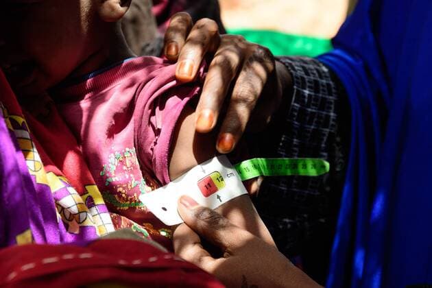 Dorfbewohner Somaliland Durch Hilfsorganisationen werden bei Kindern der Grad der Unterernährung gemessen und die notleidende Bevölkerung durch Hilfslieferungen unterstützt. In einem Dorf in Somaliland. Somaliland