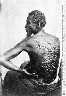 Ikonische Bilder der Zeitgeschichte The Scourged Back - The furrowed and scarred back of Gordon, a slave who escaped from his master in Mississippi and made his way to a Union Army encampment in Baton Rouge, Louisiana during the American Civil War, from the New York Public Library, 1863. 1023_05_64653final