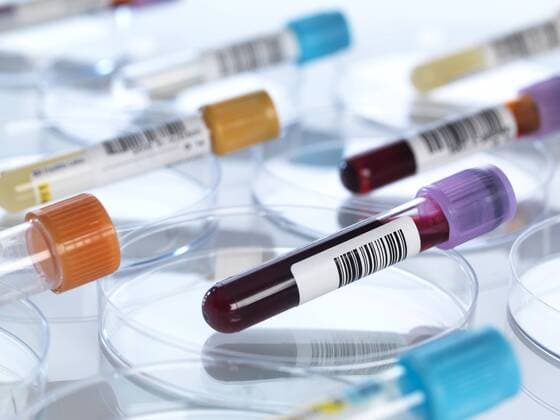 Creative Highlights Symbolfotos Human blood and other medical samples in petri dishes property released  ABRF00102