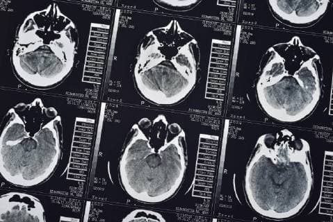  CT-Scan eines menschlichen männlichen Gehirns, Nahaufnahme *** CT scan of a human male brain. Close-up Copyright: imageBROKER/SimonxBelcher ibldig04656404.jpg
