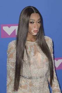 NEW YORK, NY - AUGUST 20: Winnie Harlow arriving at the 2018 MTV Video Music Awards at Radio City Music Hall in New York City on August 20, 2018. Copyright: ximageSPACEx